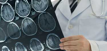 Neurological Treatment