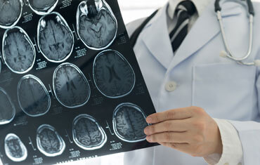 neurological treatment